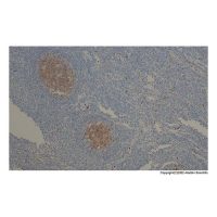 Recombinant CD10 Antibody,ExactAb™, Validated, Recombinant, 0.11 mg/mL,阿拉丁