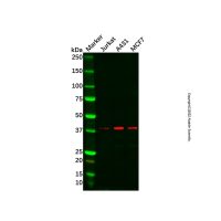 MVK Antibody,ExactAb™, Carrier Free, Validated, 1.0 mg/mL,阿拉丁