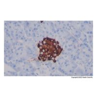 Recombinant Chromogranin A Antibody,ExactAb™, Validated, Recombinant, 0.04 mg/mL,阿拉丁