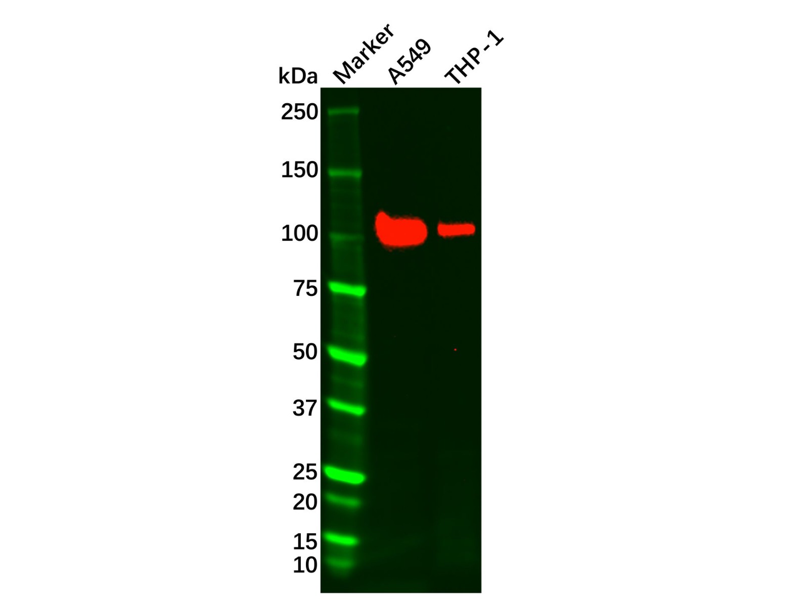 Recombinant Androgen Receptor Antibody,ExactAb™, Validated, Recombinant, High performance, 0.144 mg/mL,阿拉丁产品图