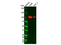 Recombinant Androgen Receptor Antibody,ExactAb™, Validated, Recombinant, High performance, 0.144 mg/mL,阿拉丁