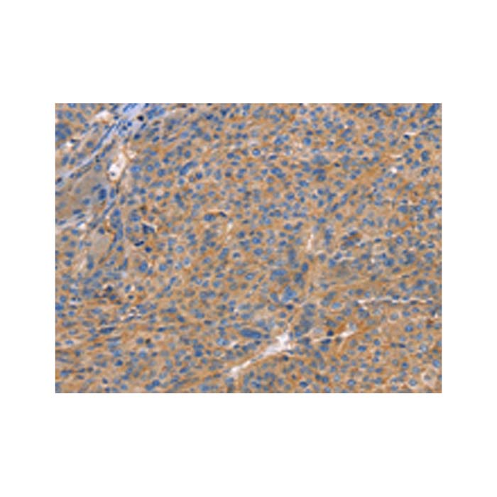 GNB1 Antibody,ExactAb™, Validated, Carrier Free, 0.2 mg/mL,阿拉丁产品图