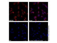 Recombinant ADK Antibody,ExactAb™, Validated, 重组, 0.7 mg/mL,阿拉丁