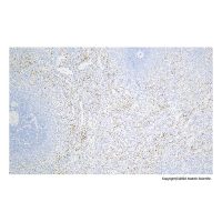 Recombinant Integrin beta 3 Antibody,重组,ExactAb™,已验证,见COA,阿拉丁