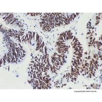 MSH6 Mouse mAb,Azide Free, Validated, Carrier Free, 1.0 mg/mL,阿拉丁
