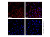 Recombinant ACAA2 Antibody,Validated, Recombinant, ExactAb™, 0.5 mg/mL,阿拉丁
