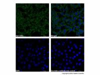 Recombinant IP3 receptor Antibody,ExactAb™, 已验证, 重组, 见COA,阿拉丁