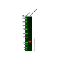 Recombinant Lambda Light Chain Antibody,重组, ExactAb™, 已验证, 见COA,阿拉丁
