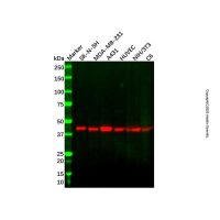 CYR61 Antibody,Validated, 1.0 mg/mL,阿拉丁