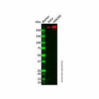 Recombinant ATM Antibody,重组, ExactAb™, 已验证, 见COA,阿拉丁