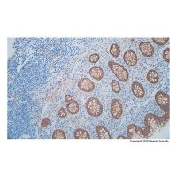 Recombinant beta Catenin Antibody，ExactAb™, Validated, Recombinant, 0.07 mg/mL，阿拉丁