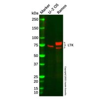 Recombinant LTK Antibody,重组, ExactAb™, 已验证, 见COA,阿拉丁