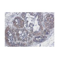 Recombinant NF-kB p65 Antibody,ExactAb™, Validated, 重组, 0.6 mg/mL,阿拉丁