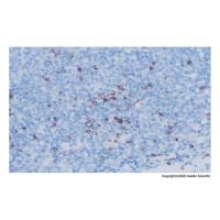 Recombinant TIA1 Antibody,ExactAb™, Validated, Recombinant, 0.15 mg/mL,阿拉丁