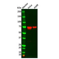 TGFBI Antibody,无载体, ExactAb™, 已验证, 高性能, 见COA,阿拉丁