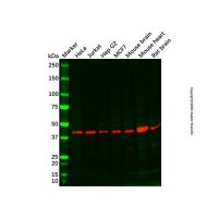 Recombinant Somatostatin Receptor 5 Antibody,重组, ExactAb™, 已验证, 见COA,阿拉丁