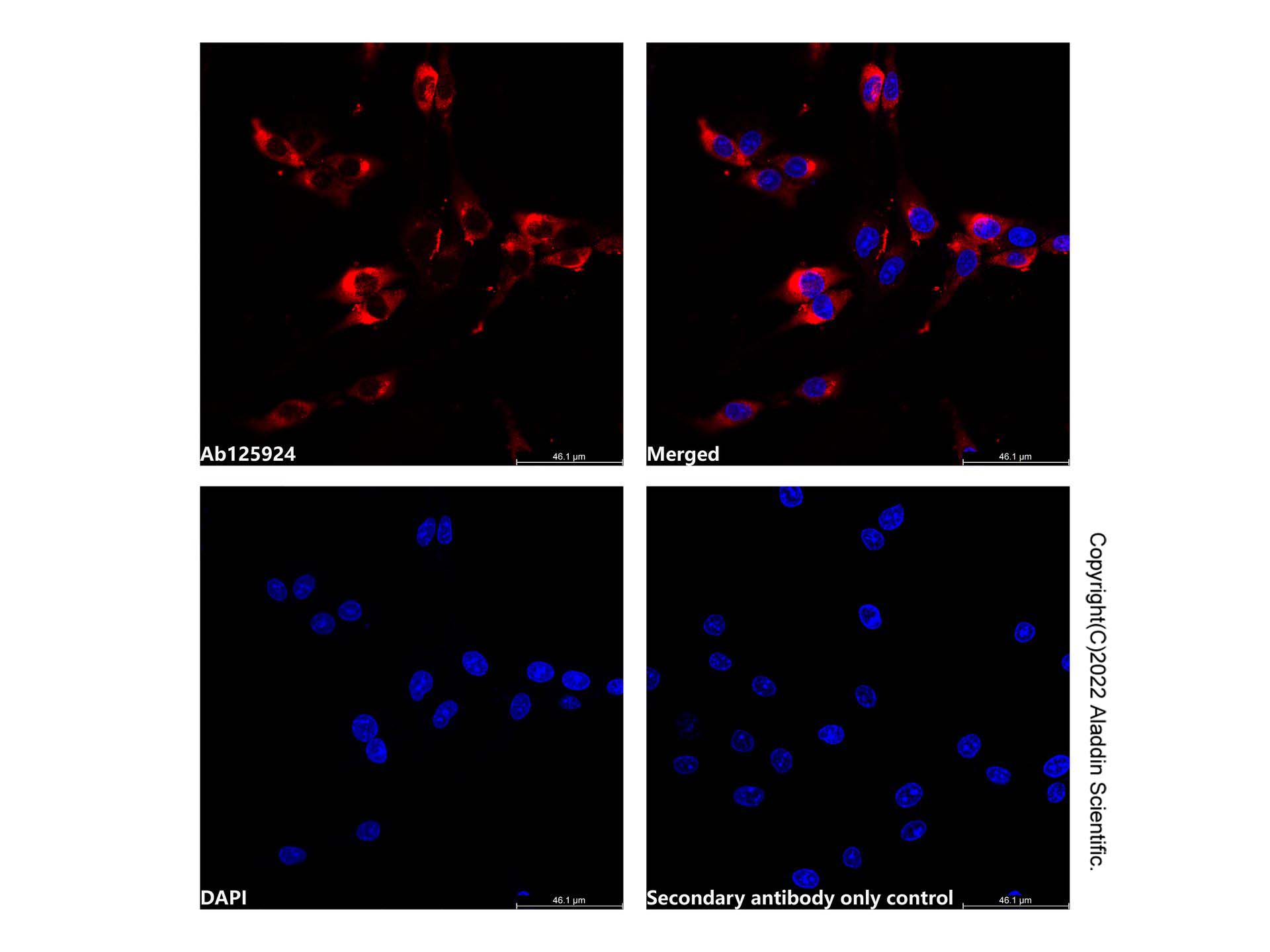 Recombinant RPS20 Antibody，ExactAb™, Validated, 重组, 2.0 mg/mL，阿拉丁产品图