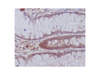 Recombinant PYK2 Antibody,ExactAb™, Validated, 重组, 0.2 mg/mL,阿拉丁