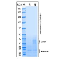 Recombinant Mouse IFN-gamma Protein,无动物源, 无载体, 生物活性, ActiBioPure™, 高性能, His标签, ≥95%(SDS-PAGE),阿拉丁