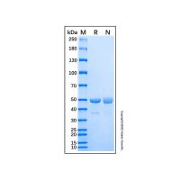 重组人RAD23A泛素结合蛋白,无载体, 生物活性, ActiBioPure™, 高性能, His标签, GST标签, ≥90%(SDS-PAGE), expressed in E. coli; 见COA,阿拉丁