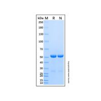 重组人RAD23A泛素结合蛋白,无载体, 生物活性, ActiBioPure™, 高性能, His标签, GST标签, ≥95%(SDS-PAGE), expressed in E. coli; 见COA ,阿拉丁