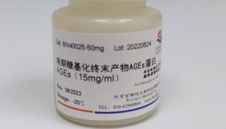 晚期糖基化终末产物AGEs