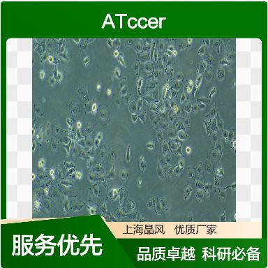 人肾母细胞瘤细胞CCLF_PEDS_0052_T细胞产品图