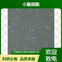 人B细胞淋巴瘤细胞Tat-1细胞