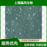 人伯基特淋巴瘤细胞MUTU-III细胞