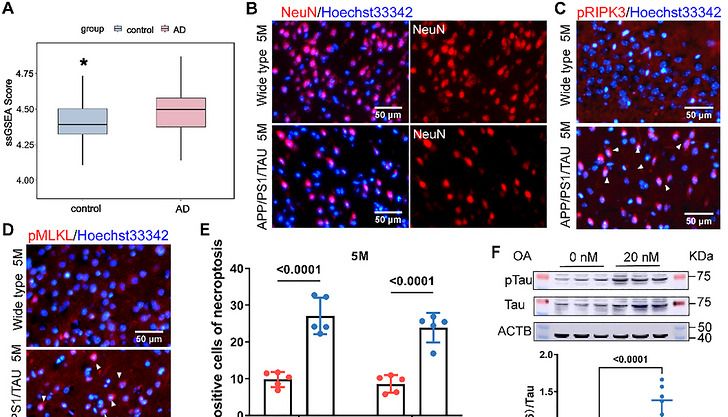 血脑屏障难题被突破！RVG工程外泌体递送siRNA靶向RIPK3，遏制阿尔茨海默病神经退行性进展