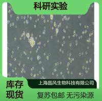 人卵巢癌细胞PEO1细胞