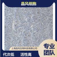 荧光素酶标记的小鼠骨髓瘤细胞SP2/0-LUC