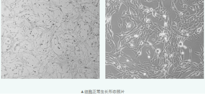 胶质母细胞瘤研究的经典株 U-87 MG，聚团问题怎么破