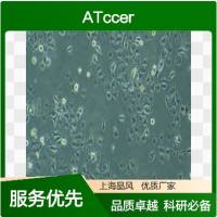 人多发性骨髓瘤细胞JK-6细胞 