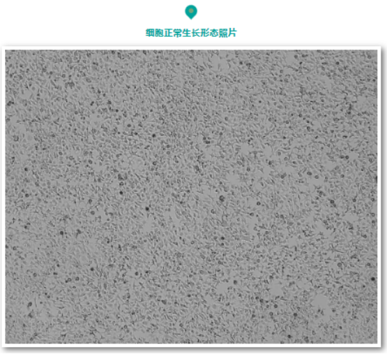 肝癌研究绕不开的 HuH-7，触角和黑点是它的“标配”