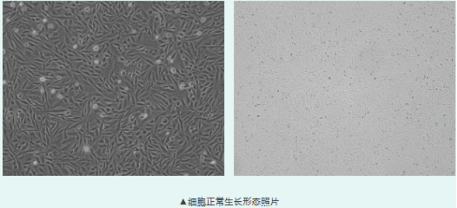鸡胚成纤维细胞 DF-1，做禽病毒和疫苗生产的重要底物