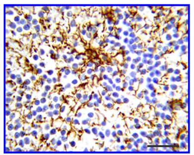 MAB360 Merck-Millipore 抗神经胶质纤维酸性蛋白抗体：星形胶质细胞标记的"金标准"克隆 GA5