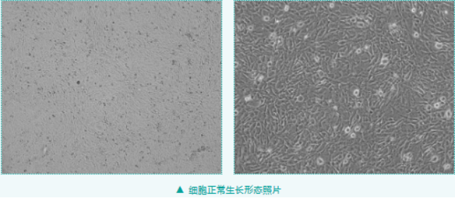 脂肪细胞分化的经典模型 3T3-L1，想养好这些细节要记住