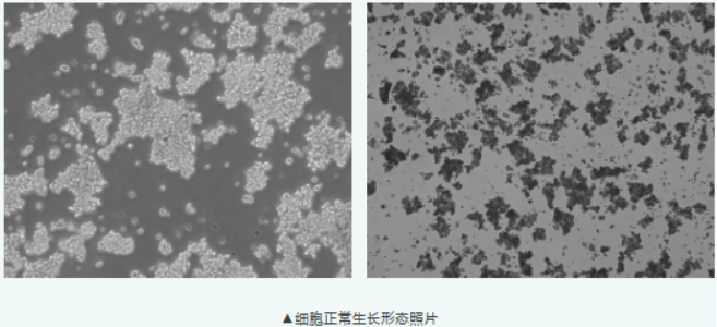 NGF 诱导神经分化的经典模型 PC-12，半贴壁怎么养