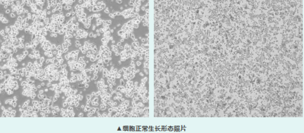 做神经分化常用的小鼠成神经细胞 Neuro-2a，漂浮细胞别乱丢