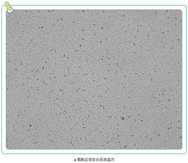 心血管研究常用的大鼠心肌细胞 H9c2(2-1)，培养要点