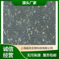 人胚胎肾细胞HEK293T-GIGYF1/2-null