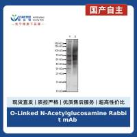 O-Linked N-Acetylglucosamine Rabbit mAb (S-R256)