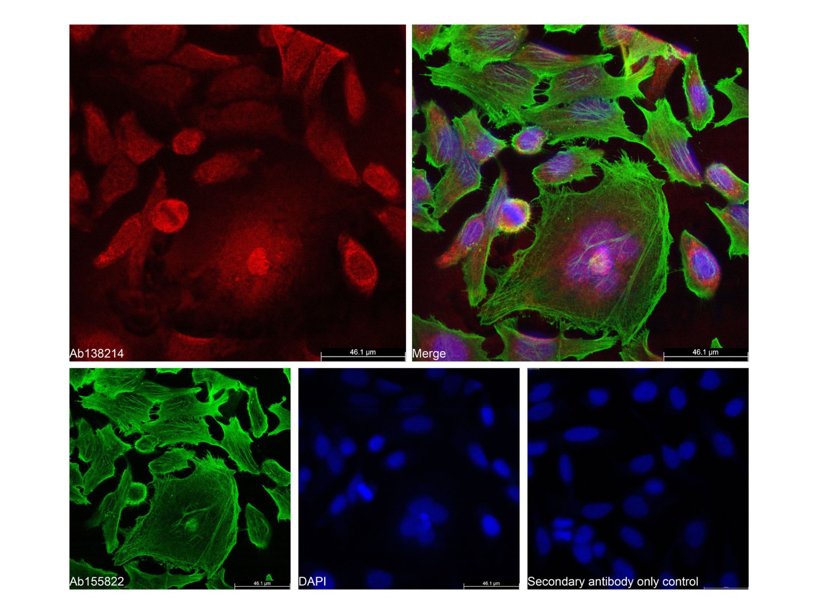 Goat Anti-Rabbit IgG H&L (AF594),ExactAb™, 高性能, 已验证, Ex:590nm, Em:618nm, 1 mg/mL,阿拉丁