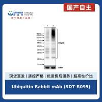Ubiquitin Rabbit mAb (SDT-R095)