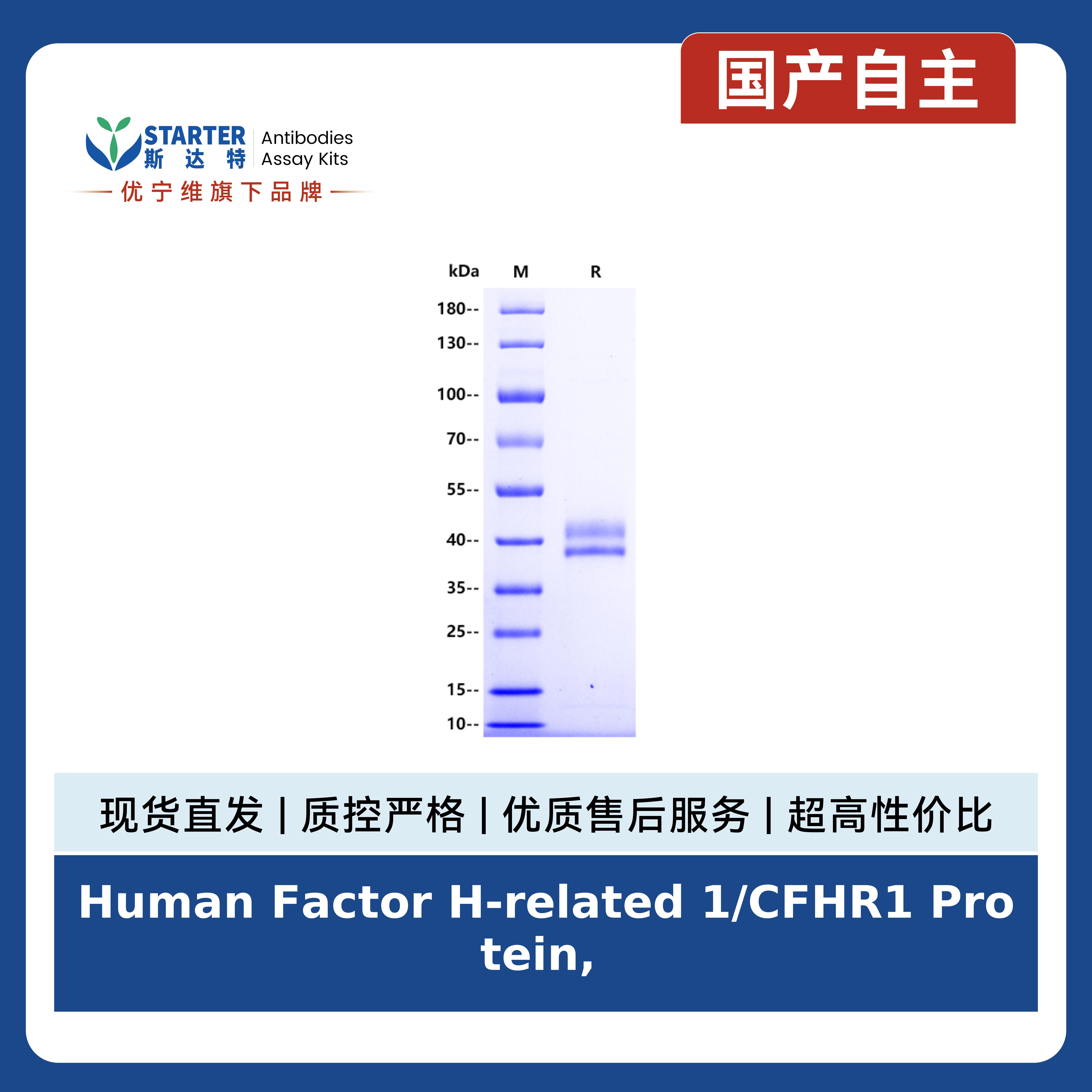 Human Factor H-related 1/CFHR1 Protein, His Tag