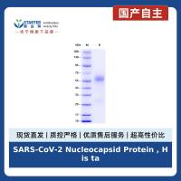 SARS-CoV-2 Nucleocapsid Protein , His tag