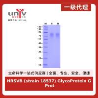 HRSVB (strain 18537) GlycoProtein G Protein, His Tag