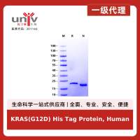 KRAS(G12D) His Tag Protein, Human