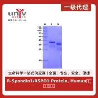 R-Spondin1/RSPO1 Protein, Human类器官培养专用